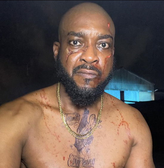 I Suffered Facial Paralysis That's Why I Took a Break From Acting - Nollywood Actor, Chidi Mokeme