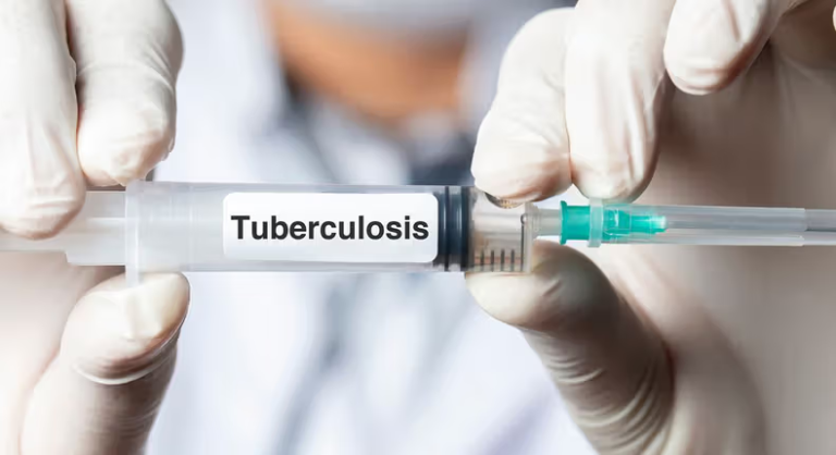Nigeria records 590,000 new Tuberculosis yearly - Public Health physician