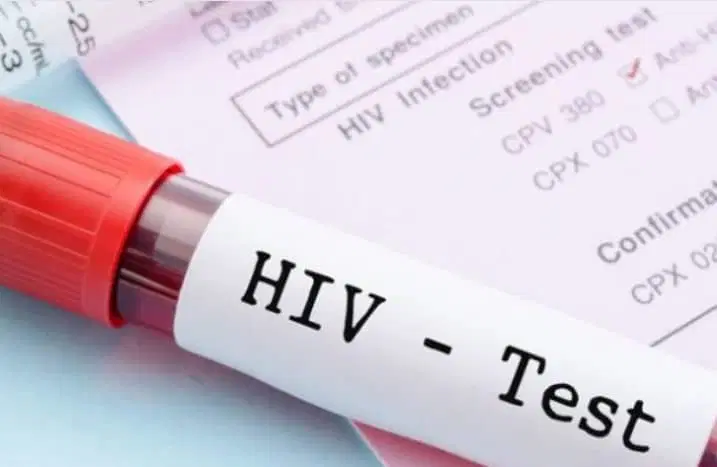 hiv