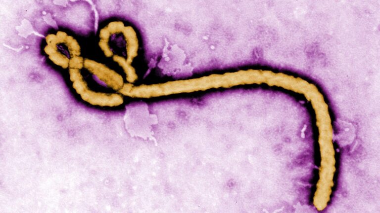 Cynthia GoldsmithThis colorized transmission electron micrograph (TEM) revealed some of the ultrastructural morphology displayed by an Ebola virus virion. See PHIL 1181 for a black and white version of this image.<b>What is Ebola hemorrhagic fever (Ebola HF)?</b><p>Ebola hemorrhagic fever (Ebola HF) is a severe, often-fatal disease in humans and nonhuman primates (monkeys, gorillas, and chimpanzees) that has appeared sporadically since its initial recognition in 1976.<p>The disease is caused by infection with Ebola virus, named after a river in the Democratic Republic of the Congo (formerly Zaire) in Africa, where it was first recognized. The virus is one of two members of a family of RNA viruses called the Filoviridae. There are four identified subtypes of Ebola virus. Three of the four have caused disease in humans: Ebola-Zaire, Ebola-Sudan, and Ebola-Ivory Coast. The fourth, Ebola-Reston, has caused disease in nonhuman primates, but not in humans.